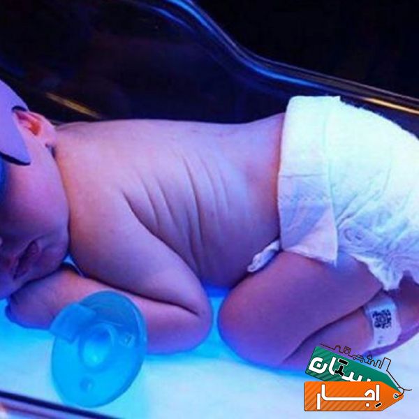 اجاره دستگاه زردی نوزاد در منزل