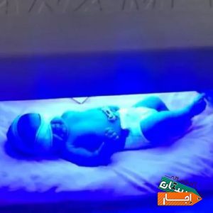 اجاره دستگاه زردی نوزاد و شیردوش برقی در منزل .با بهترین قیمت