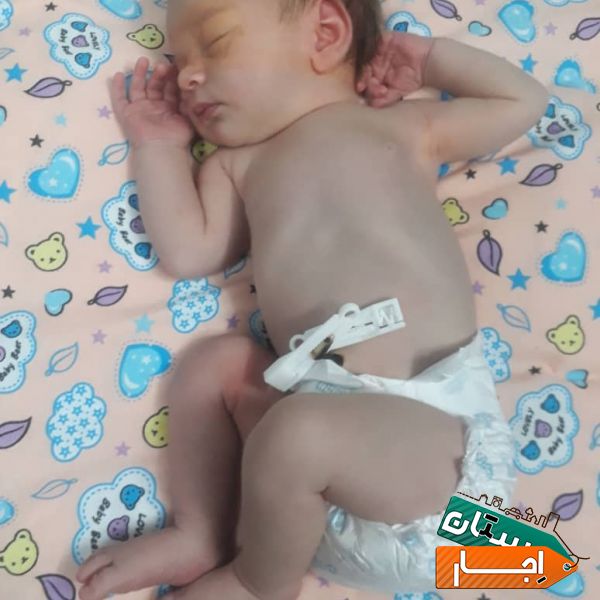 اجاره دستگاه زردی فتوتراپی