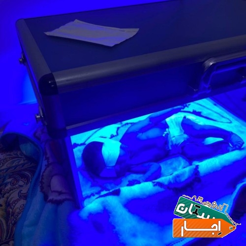 اجاره دستگاه زردی نوزاد/فتوتراپی(سراسر البرز)