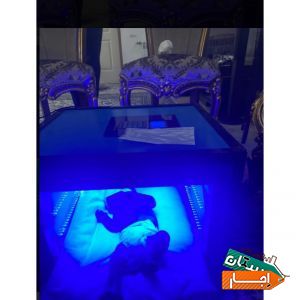 اجاره دستگاه زردی نوزاد /فتوتراپی(سراسر کرج)