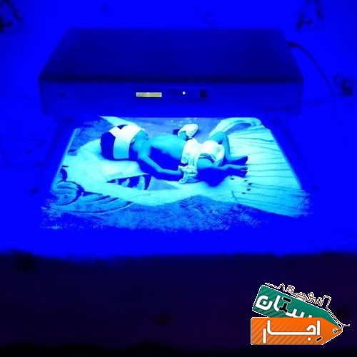 اجاره دستگاه درمان زردی نوزاد ( فتوتراپی )