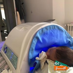 اجاره دستگاه زردی نوزاد شبانه روزی