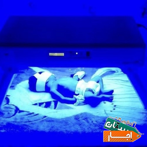 اجاره دستگاه درمان زردی نوزاد ( فتوتراپی )