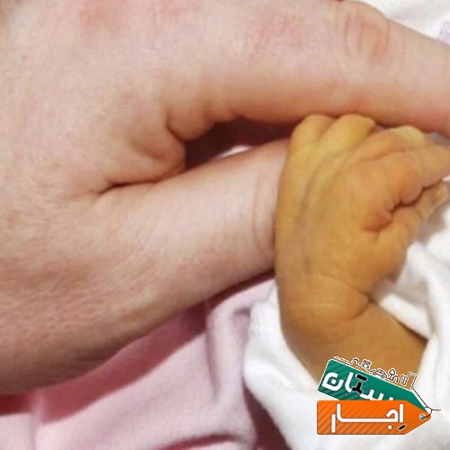 اجاره دستگاه زردی نوزاد (فتوتراپی)ارسال کل تهران