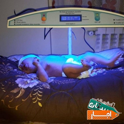 خدمات اجاره دستگاه زردی فتوتراپی تخصصی