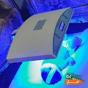اجاره دستگاه زردی نوزاد 4D(فتوتراپی) با بهترین قیمت