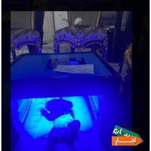 اجاره دستگاه زردی نوزاد /فتوتراپی(سراسر کرج)