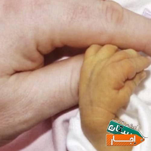 اجاره دستگاه زردی نوزاد (فتوتراپی)ارسال کل تهران
