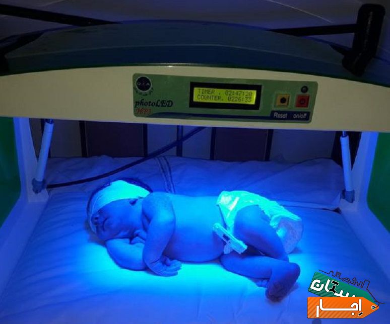 اجاره ی دستگاه رفع زردی نوزاد