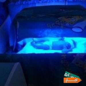 اجاره دستگاه فتوتراپی جهت درمان زردی در منزل