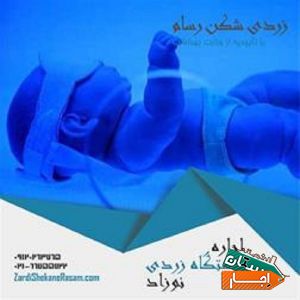 اجاره دستگاه زردی شکن نوزاد