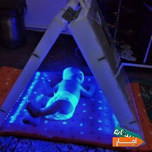 اجاره دستگاه زردی LED تونلی خانگی و بیمارستانی