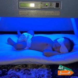اجاره دستگاه زردی نوزاد و شیردوش برقی بیمارستانی