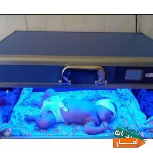 اجاره دستگاه زردی نوزاد/فتوتراپی(سراسرکرج)