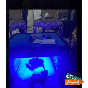 اجاره دستگاه زردی نوزاد /فتوتراپی(سراسر کرج)