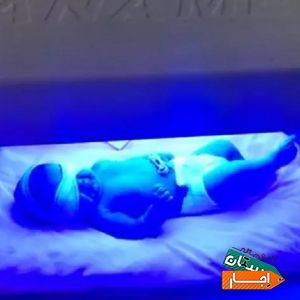اجاره دستگاه زردی نوزاد و شیردوش برقی در منزل . با بهترین امکانات