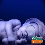 اجاره-دستگاه-فتوتراپی-زردی-نوزاد