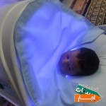 خدمات-اجاره-دستگاه-زردی