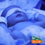 اجاره-دستگاه-فتوتراپی-زردی-نوزاد