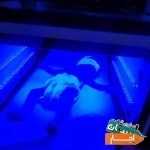 اجاره-دستگاه-زردی-نوزادوشیردوش-برقی-بیمارستانی