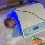 اجاره-دستگاه-زردی-نوزادان-در-شهریار-اندیشه-و-حومه
