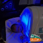 خدمات-اجاره-دستگاه-زردی-نوزاد