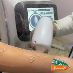 اجاره-رنت-دستگاه-لیزر