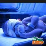 خدمات-اجاره-دستگاه-زردی-نوزاد-فتوتراپی