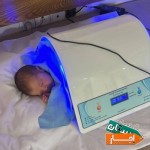 اجاره-دستگاه-زردی-نوزاد-در-پرند-رباط-کریم-و-حومه