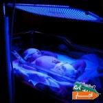 اجاره-دستگاه-زردی-نوزاد-شبانه-روزی-تمام-مناطق