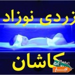 اجاره-دستگاه-زردی-نوزاد-در-کاشان