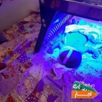 اجاره-دستگاه-رفع-زردی-نوزاد-در-منزل-فتوتراپی