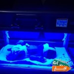 اجاره-دستگاه-زردی-نوزاد-فتوتراپی-همه-مناطق-تهران