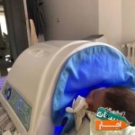 اجاره-دستگاه-زردی-نوزاد-کودک-فتوتراپی