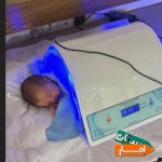 اجاره-دستگاه-زردی-نوزاد-در-شهریار-اندیشه-و-حومه