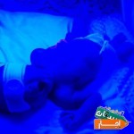 اجاره-دستگاه-فتوتراپی-و-زردی-نوزاد-قیمت-کیفیت-عالی